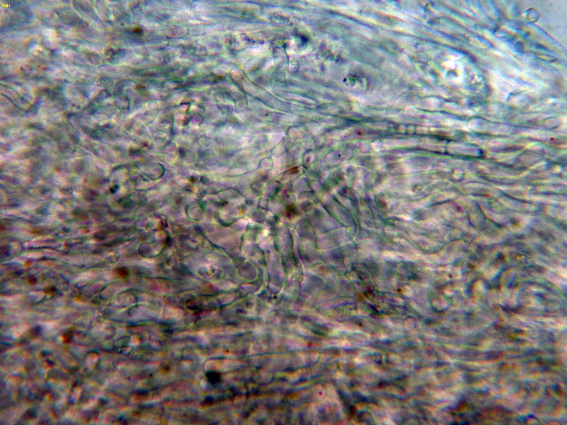 Microscopía de Russula cessans - 10 - Subpellis agua-002